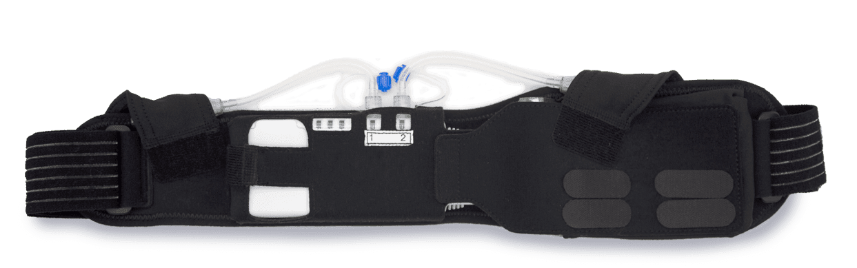 SOMAVAC in belt: smart surgical drain pump worn discreetly under clothing